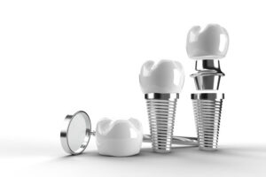 tooth implant sections being displayed with a white background and a small mirrored tool