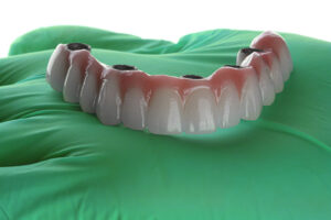 a full arch of teeth with 4 holes for implants to be placed onto the jaw