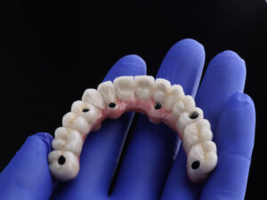 Photo dental implant work is completed and ready to use dental implant temporary abutment, a doctor with blue gloves on holding hand flat.