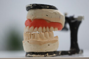 a denture model with the dentures on top of the jaw