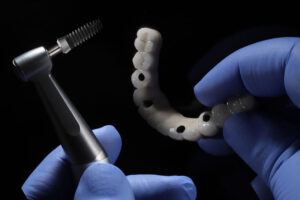 a full arch of teeth with holes for implants to be placed inside