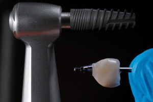 a tooth being held up next to a porcelain crown and a drill