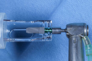 dental implant drill being shown where its ready to place an implant