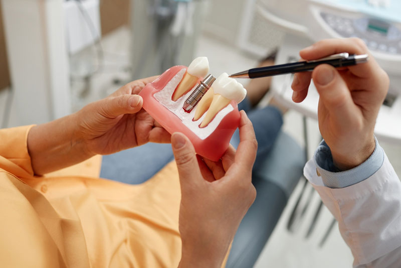 Dentist explaining a dental implant procedure using a 3D model during a patient consultation in a dental clinic.