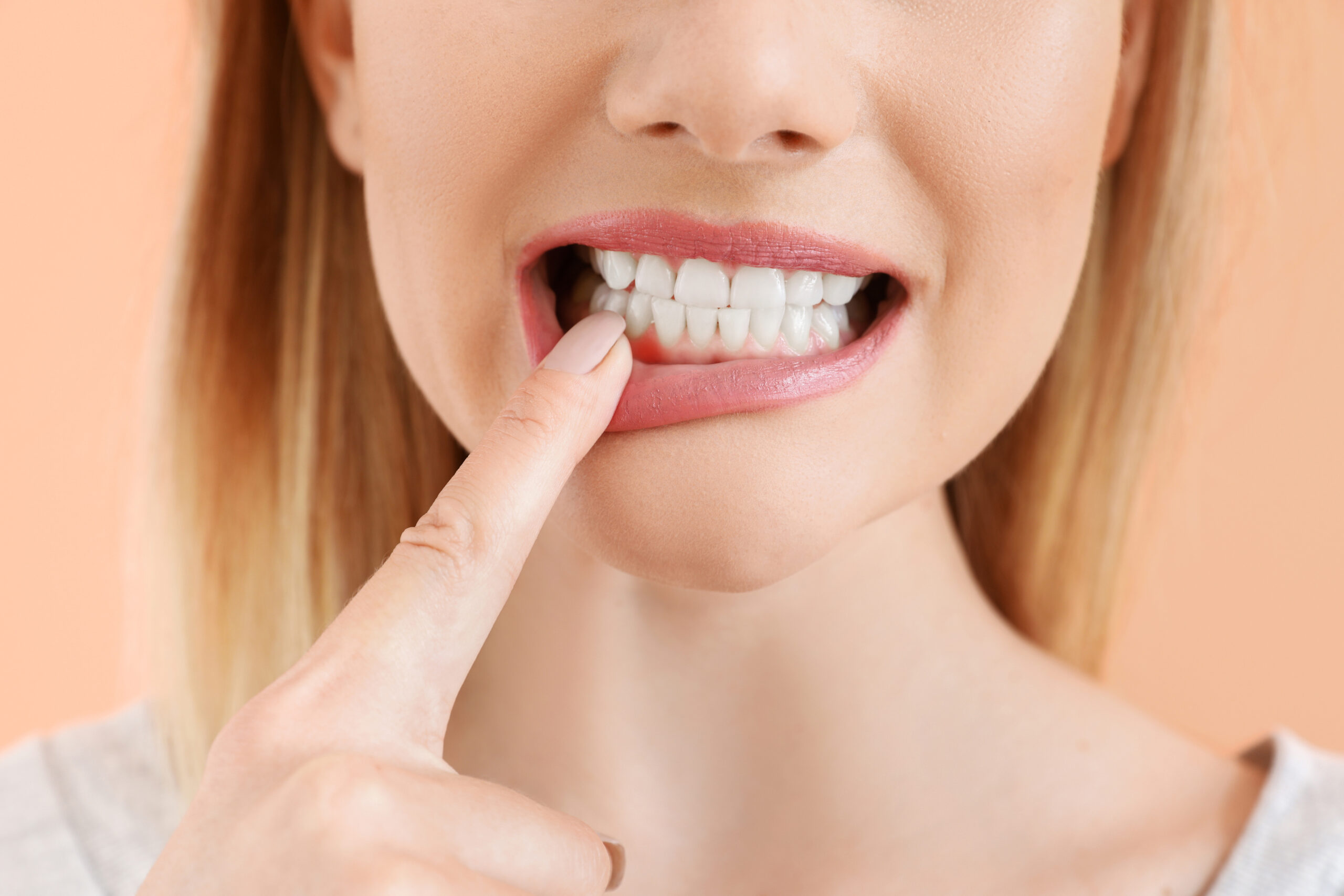 Effective Solutions for Fixing a Chipped Tooth