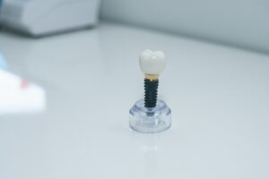 Why Replacing Missing or Damaged Teeth Is Essential for Oral Health