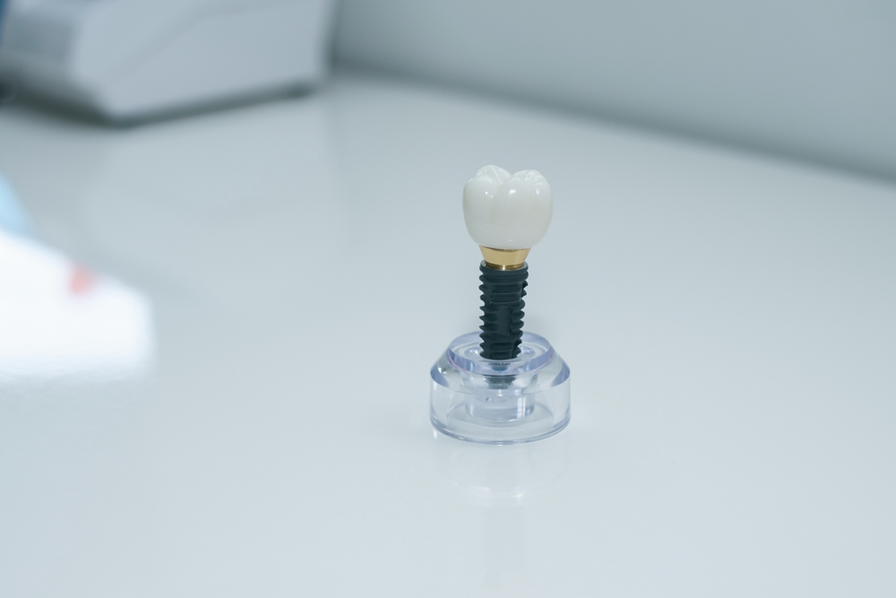 Why Replacing Missing or Damaged Teeth Is Essential for Oral Health